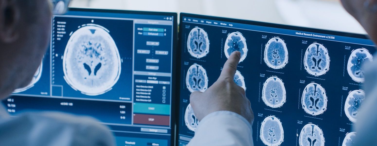 male doctors looking at x-ray images